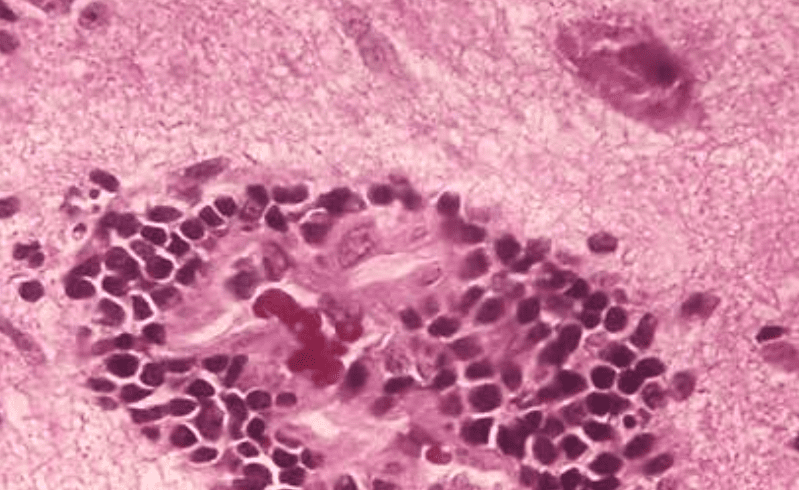 Rabies: The Facts You Should Know, and How to Avoid This Disease